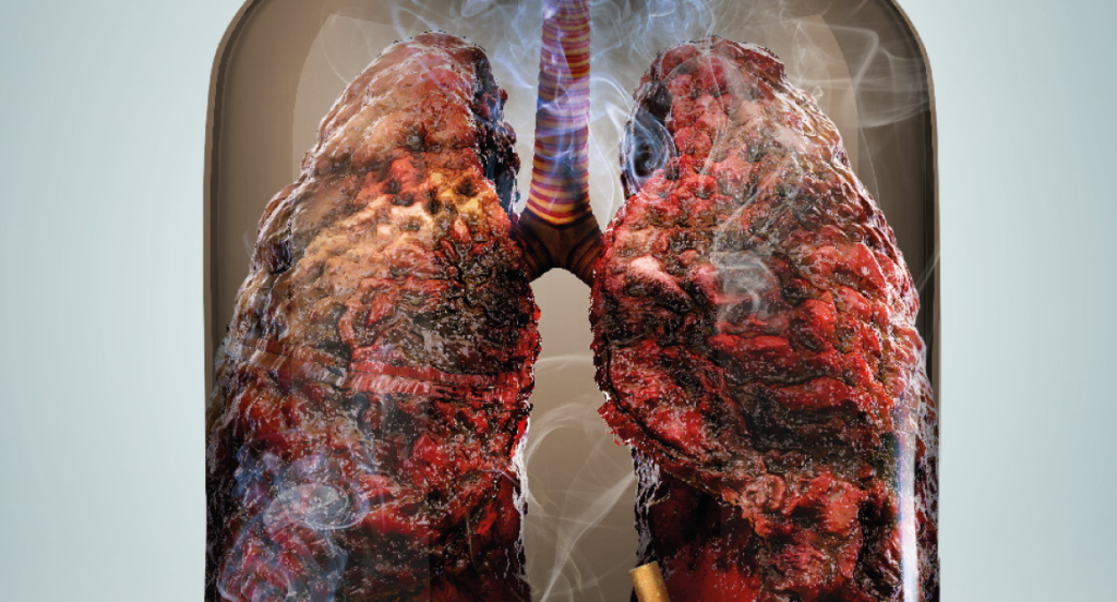 The side effects of smoking on the lungs